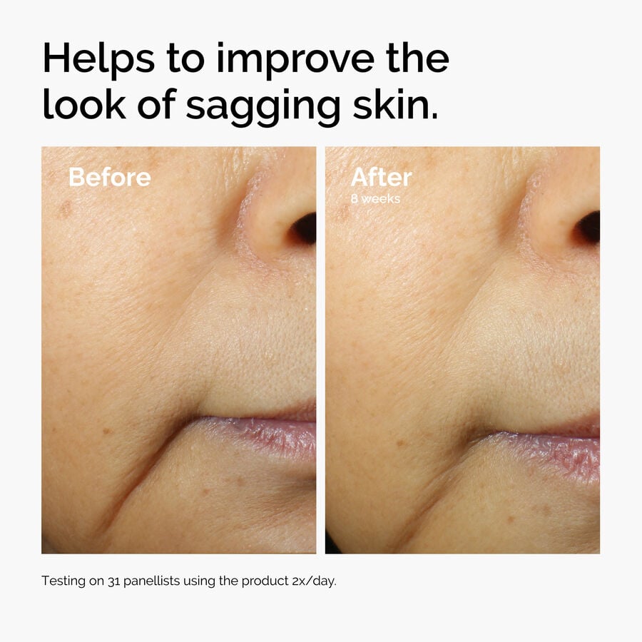caffeine-3-escin-1-face-serum-v7 ord-caffeine-3pct-escin-1pct-face-serum-before-after-sagging.jpg