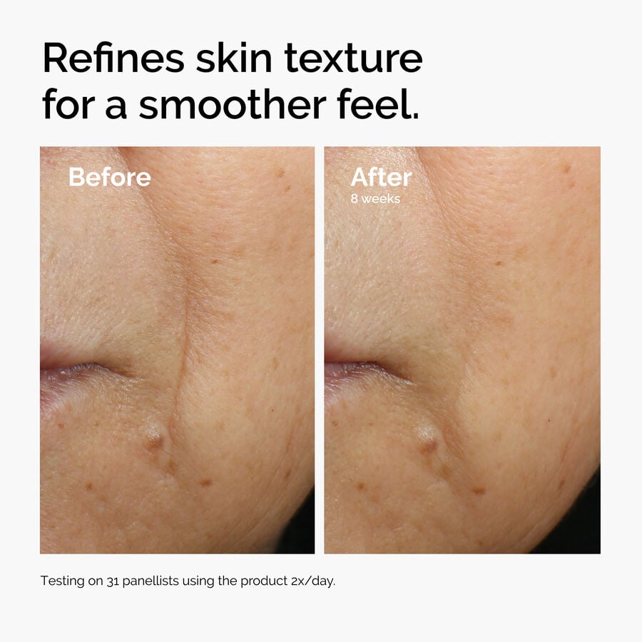 caffeine-3-escin-1-face-serum-v7 ord-caffeine-3pct-escin-1pct-face-serum-before-after-texture.jpg