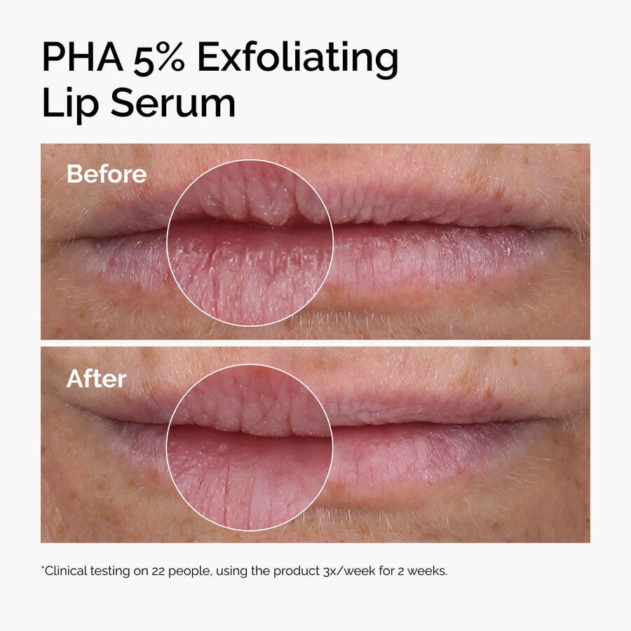 pha-5-exfoliating-lip-serum-p4 ord-pha-5pct-lip-exfoliating-serum-before-after.jpg